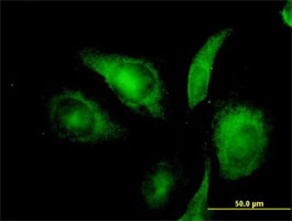 NIFUN Antibody (monoclonal) (M01)