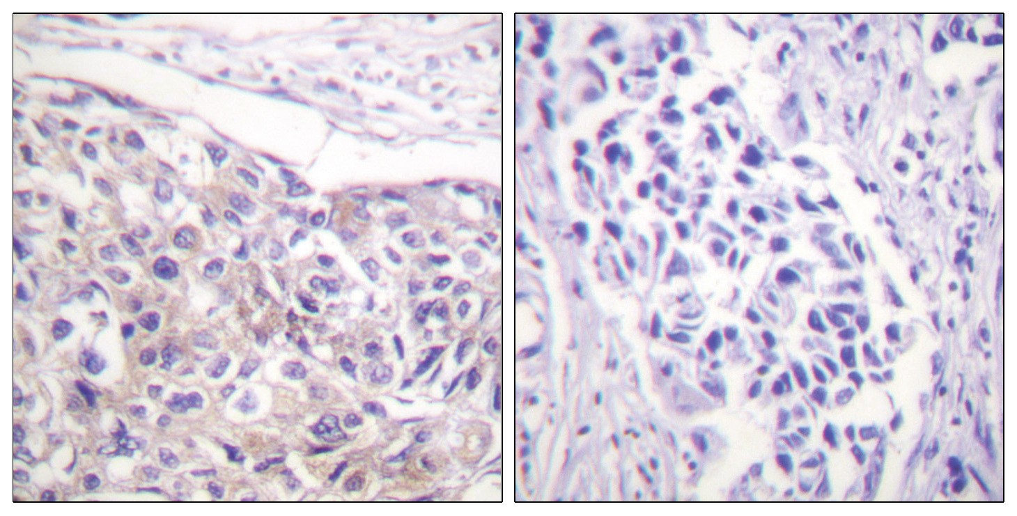 p90 RSK (phospho Thr573) Antibody