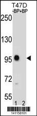 CTNNB1 Antibody
