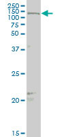 MAML2 Antibody (monoclonal) (M03)