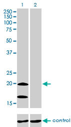 NDUFS4 Antibody (monoclonal) (M01)