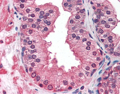 IGF1 Receptor Antibody