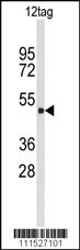 GFP tag Polyclonal Antibody