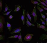 Progesterone Receptor Antibody
