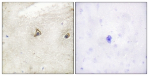 c-Abl antibody