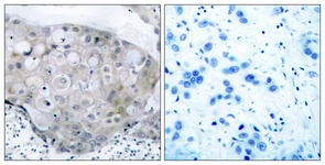 VEGFR2 (Phospho-Tyr951) antibody