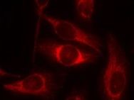 p53 (phospho Ser46) Antibody