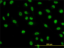 NFIC Antibody (monoclonal) (M03)