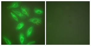 Keratin 18 antibody