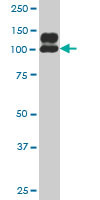 NDST1 Antibody (monoclonal) (M03)