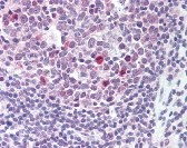 BCL2 Antibody