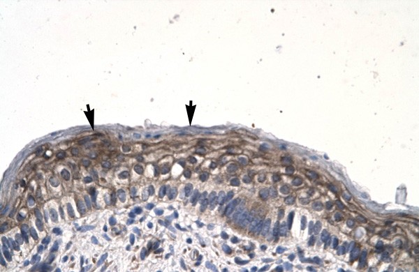 JMJD8 antibody