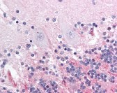 APP Antibody
