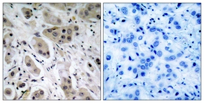 Akt (Phospho-Ser473) antibody