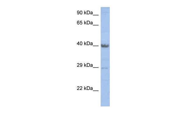 ZNF474 antibody