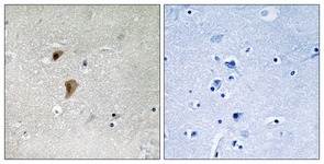 HSF1 (Phospho-Thr142) antibody