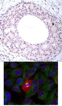 NFkB p65 (phospho Thr254) Antibody