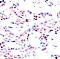 c Jun (phospho Thr91) Antibody
