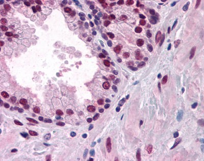 Androgen receptor Antibody