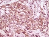 4E-BP1 Antibody