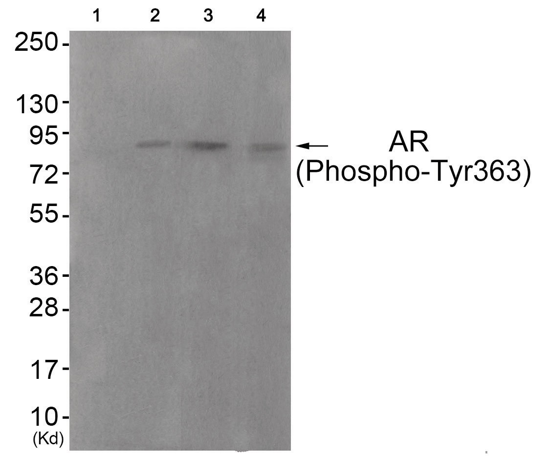 Androgen Receptor (phospho Tyr363) Antibody