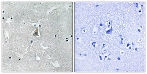 Bax (Phospho-Ser184) antibody