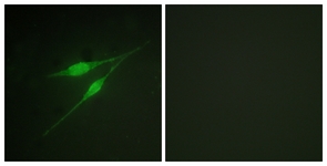 p38 MAPK antibody
