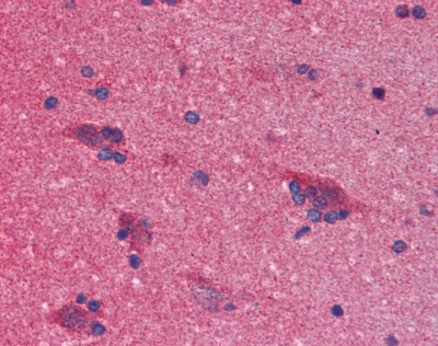 Alpha-Synuclein Antibody