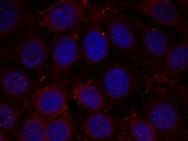 IGF 1R (phospho Tyr1165 / Tyr1166) Antibody