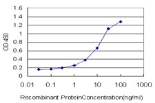 NSDHL Antibody (monoclonal) (M01)