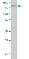 MAP3K4 Antibody (monoclonal) (M08)