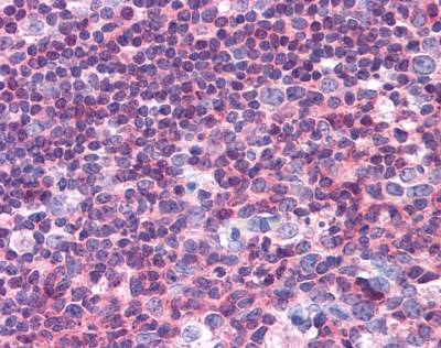 PYK2 Antibody