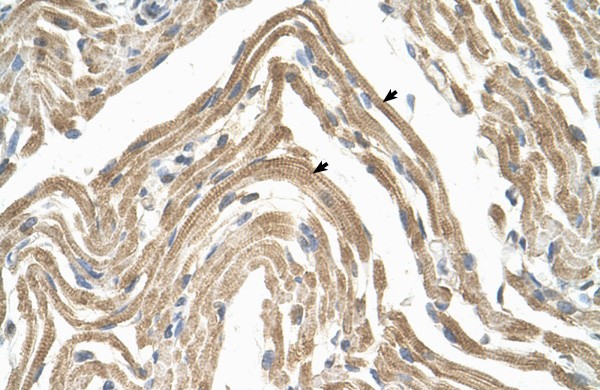 CCBP2 antibody - N-terminal region