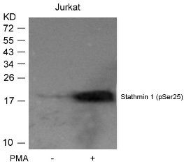 Stathmin 1 (phospho Ser25) Antibody