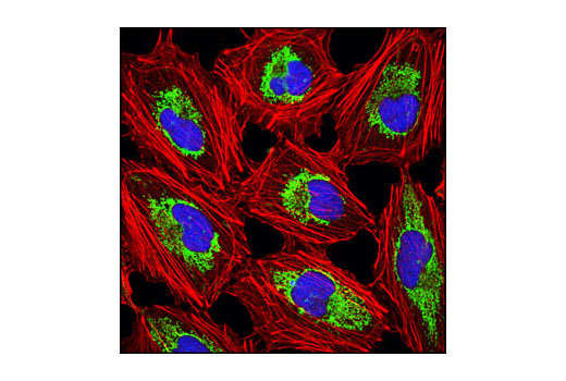 Anti-rat IgG (H+L), (Alexa Fluor ® 647 Conjugate)