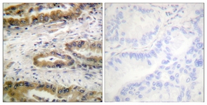 VEGFR2 (Phospho-Tyr1054) antibody