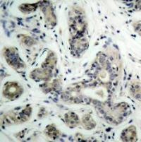 BAD (phospho Ser136) Antibody