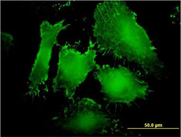 MAGI1 Antibody (monoclonal) (M03)