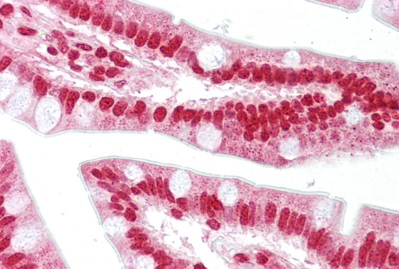 OAS1 antibody