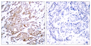 Myc (Phospho-Thr58) antibody