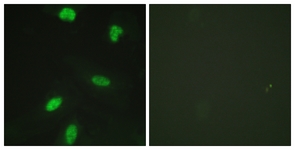 Retinoblastoma (Phospho-Thr821) antibody