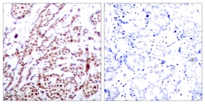 ATF2 (Phospho-Thr73 or 55) antibody