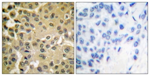 Smad3 (Phospho-Ser425) antibody