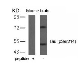 Tau (phospho Ser214) Antibody