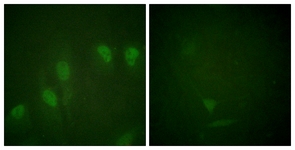 Myc (Phospho-Ser62) antibody