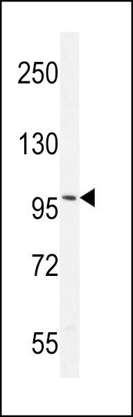 Androgen Receptor Antibody