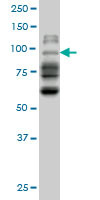 NBR1 Antibody (monoclonal) (M01)