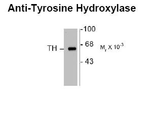 Tyrosine Hydroxylase Antibody