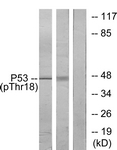 Rabbit anti-p53 (Phospho-Thr18) polyclonal antibody