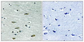 IGF1R antibody